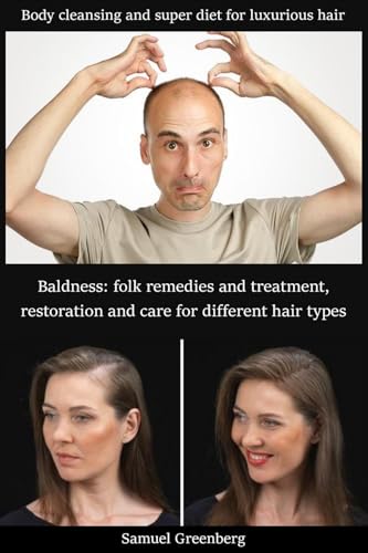 کاور کتاب Baldness: folk remedies and treatment, restoration and care for different hair types: Body cleansing and super diet for luxurious hair Kindle Edition