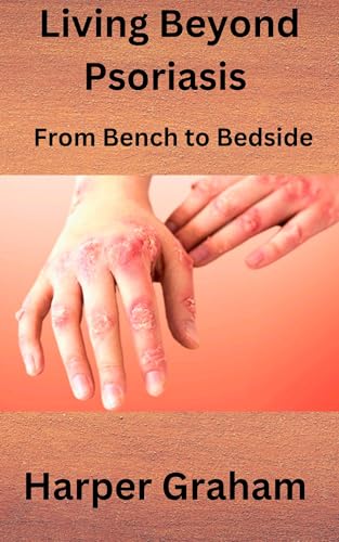 کاور کتاب Living Beyond Psoriasis : From Bench to Bedside