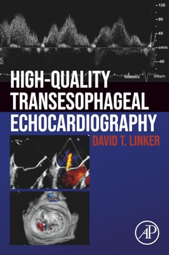کاور کتاب High-Quality Transesophageal Echocardiography 1st Edition by David T. Linker (Author)