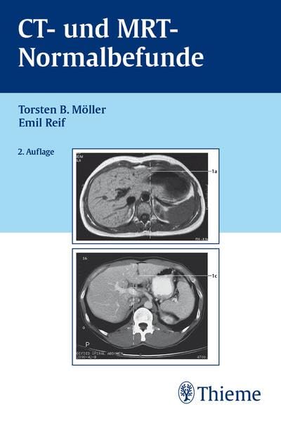 کاور کتاب CT- und MRT- Normalbefunde