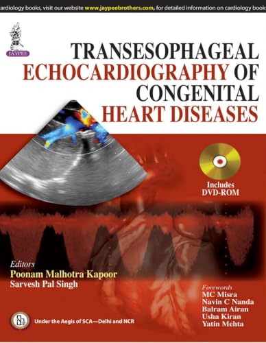 کاور کتاب Transesophageal Echocardiography of Congenital Heart Diseases Transesophageal Echocardiography of Congenital Heart Diseases
