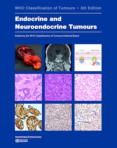 کاور کتاب Endocrine and Neuroendocrine Tumours: WHO Classification