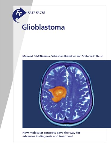 کاور کتاب Fast Facts: Glioblastoma