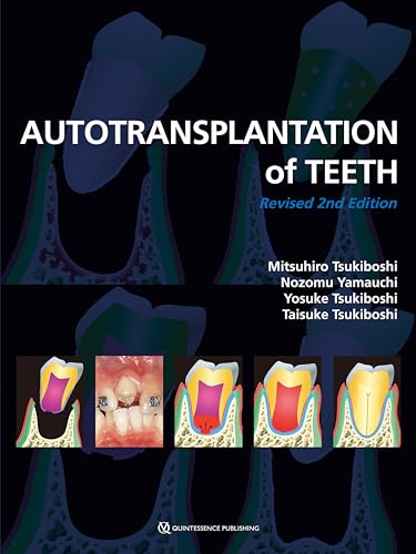 کاور کتاب Autotransplantation of Teeth