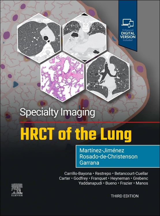 کاور کتاب Specialty Imaging: HRCT of the Lung
