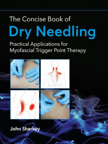 کاور کتاب The Concise Book of Dry Needling: A Practitioner's Guide to Myofascial Trigger Point Applications