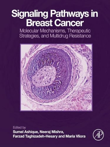 کاور کتاب Signaling Pathways in Breast Cancer: Molecular Mechanisms, Therapeutic Strategies, and Multidrug Resistance